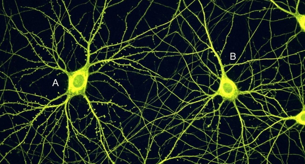 Closed-Loop Optogenetics in Freely Moving Mice