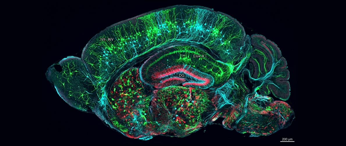 AAV capsid tropism across brain regions